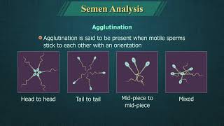 Semen Analysis [upl. by Fatsug]