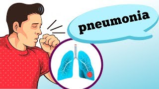 O QUE É PNEUMONIA QUAIS SUAS CAUSAS E SINTOMAS [upl. by Kraska120]