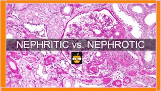 Nephritic vs Nephrotic Syndromes [upl. by Haze]