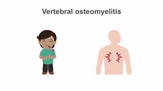 Osteomyelitis  Symptoms amp Causes🩺 [upl. by Nosilla]