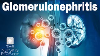 Renal Emergencies Glomerulonephritis [upl. by Denoting894]