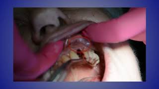 Case of the Week Immediate Extraction and Implant Placement [upl. by Knoll18]