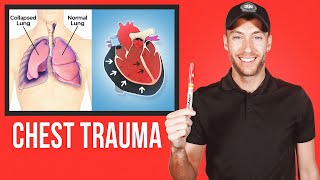 EASY Guide for CHEST TRAUMA [upl. by Nodnorb]