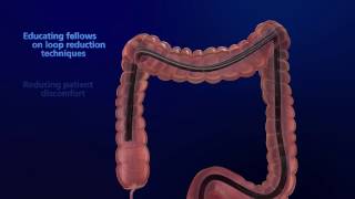 Upper GI Endoscopy  Nucleus Health [upl. by Spancake]