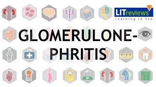 Glomerulonephritis [upl. by Sesmar]