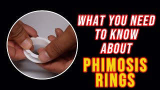 What you need to know about PHIMOSIS RINGS [upl. by Ahsitil629]