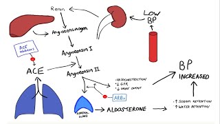 Glomerulonephritis Part2 [upl. by Nnylarak]